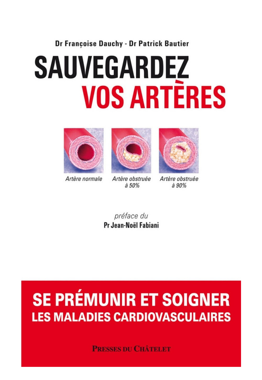 SAUVEGARDEZ VOS ARTÈRES