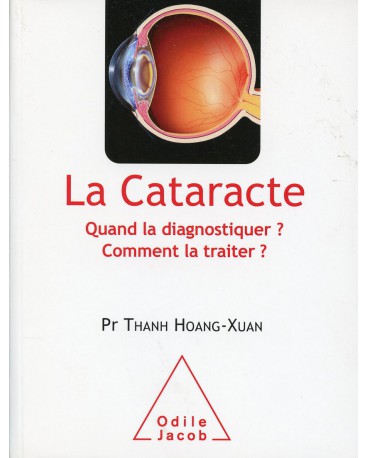 CATARACTE (LA) Quand la diagnostiquer ? Comment la traiter ?