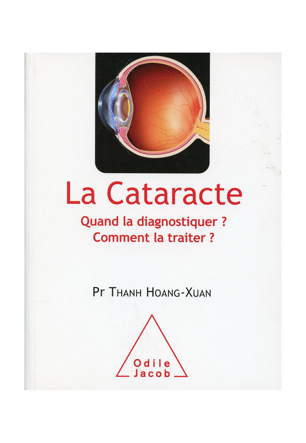 CATARACTE (LA) Quand la diagnostiquer ? Comment la traiter ?